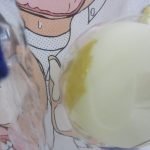 ピンポン玉の拡大。表面に黄色い変色があります。