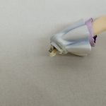 外れた腕の付け根のアップ